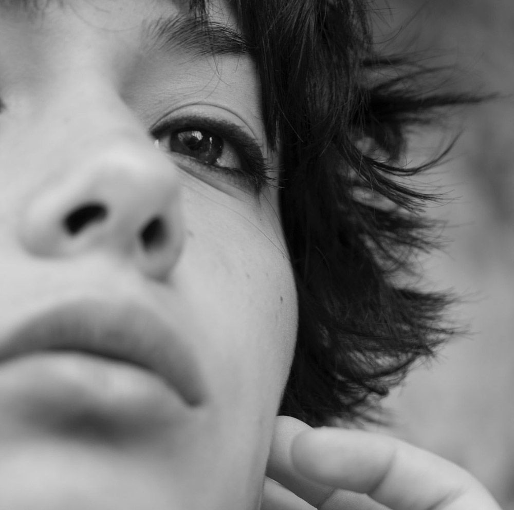 Why People Seek Revision Nose Surgery and the Expected Recovery
